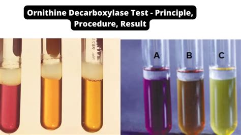 ornithine test microbiology.